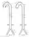 Fig. 24 - Intra-aortic balloon apparatus, assist devices and methods for improving flow, counterpulsation and haemodynamics