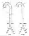Fig. 28 - Intra-aortic balloon apparatus, assist devices and methods for improving flow, counterpulsation and haemodynamics