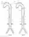 Fig. 29 - Intra-aortic balloon apparatus, assist devices and methods for improving flow, counterpulsation and haemodynamics