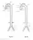 Fig. 32 - Intra-aortic balloon apparatus, assist devices and methods for improving flow, counterpulsation and haemodynamics