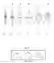 Fig. 34 - Intra-aortic balloon apparatus, assist devices and methods for improving flow, counterpulsation and haemodynamics