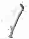 Fig. 02 - IRRIGATOR FOR WASHING WHILE SURGERY OPERATION