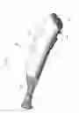 Fig. 02 - IRRIGATOR FOR WASHING WHILE SURGERY OPERATION