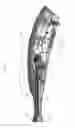 Fig. 03 - IRRIGATOR FOR WASHING WHILE SURGERY OPERATION