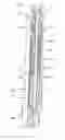 Fig. 01 - Drug delivery device