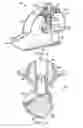 Fig. 06 - Oscillating positive expiratory pressure device