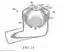 Fig. 10 - Oscillating positive expiratory pressure device