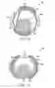 Fig. 14 - Oscillating positive expiratory pressure device