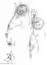 Fig. 12 - Filtration unit useable in a respiratory therapy device