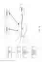 Fig. 15 - Vibrating pillow strip and operating methods