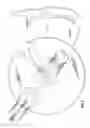 Fig. 07 - Systems and methods for providing securement and position verification for medical catheters