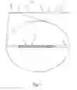 Fig. 02 - Balloon catheter system and method of using same