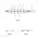 Fig. 04 - Balloon catheter system and method of using same