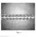 Fig. 09 - Balloon catheter system and method of using same