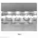 Fig. 10 - Balloon catheter system and method of using same