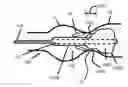 Fig. 01 - Positionable valvuloplasty catheter