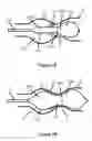 Fig. 04 - Positionable valvuloplasty catheter