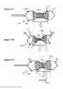 Fig. 08 - Positionable valvuloplasty catheter