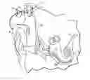 Fig. 01 - Apparatus for delivery of pharmaceuticals to the cochlea