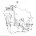 Fig. 02 - Apparatus for delivery of pharmaceuticals to the cochlea