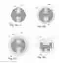 Fig. 07 - Drug delivery system for one or more active ingredients