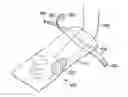 Fig. 01 - Apparatus and method for deploying a surgical preparation