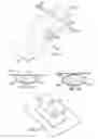 Fig. 03 - Apparatus and method for deploying a surgical preparation