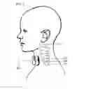 Fig. 08 - Devices and methods for non-invasive capacitive electrical stimulation and their use for vagus nerve stimulation on the neck of a patient