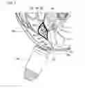 Fig. 09 - Devices and methods for non-invasive capacitive electrical stimulation and their use for vagus nerve stimulation on the neck of a patient