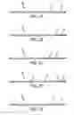 Fig. 04 - Method of treating a neurological disorder using network stimulation