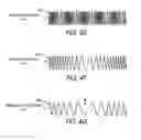 Fig. 08 - Method of treating a neurological disorder using network stimulation