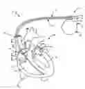 Fig. 01 - Seal plug
