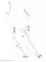 Fig. 04 - TETHERED AND/OR VISUALLY CODED BRACHYTHERAPY DEVICES AND RELATED METHODS