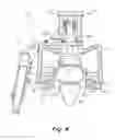 Fig. 05 - Arm extension exercise apparatus