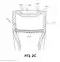 Fig. 05 - Swing training device