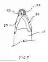 Fig. 03 - BOXING BAG FOR HOOK PUNCHES