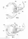 Fig. 04 - Toy apparatus