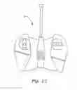 Fig. 24 - Flying Toy Aircraft With a Timer Device