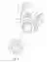 Fig. 10 - Oil filter assembly having rotation type drain pin