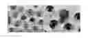 Fig. 01 - Device for isolating periphery circulating tumor cells or rare cells, and method of isolating periphery circulating tumor cells or rare cells