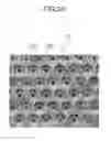 Fig. 04 - Device for isolating periphery circulating tumor cells or rare cells, and method of isolating periphery circulating tumor cells or rare cells