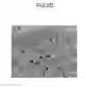 Fig. 07 - Device for isolating periphery circulating tumor cells or rare cells, and method of isolating periphery circulating tumor cells or rare cells