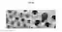 Fig. 12 - Device for isolating periphery circulating tumor cells or rare cells, and method of isolating periphery circulating tumor cells or rare cells