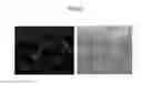 Fig. 16 - Device for isolating periphery circulating tumor cells or rare cells, and method of isolating periphery circulating tumor cells or rare cells