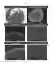 Fig. 03 - Carrier for dry adsorbent for carbon dioxide including spherical silica whose surface is engraved in the form of nanowires and method for preparing the same