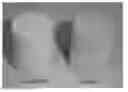 Fig. 01 - MONOLITHIC STRUCTURED CATALYST FOR CARBON MONOXIDE GASE-PHASE COUPLING TO DIALKYL OXALATE & PREPARATION METHOD AND APPLICATION THEREOF