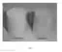 Fig. 02 - MONOLITHIC STRUCTURED CATALYST FOR CARBON MONOXIDE GASE-PHASE COUPLING TO DIALKYL OXALATE & PREPARATION METHOD AND APPLICATION THEREOF