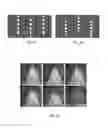 Fig. 05 - A Microfluidic Device with Pillars