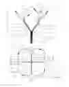 Fig. 04 - Retrieval snare for extracting foreign objects from body cavities and method for manufacturing thereof