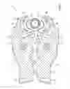 Fig. 05 - Pressing tool with axial stroke working in opposite directions